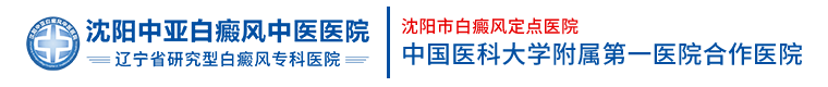 沈阳中亚白癜风中医医院